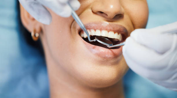 Best Emergency Dentist for Knocked-Out Tooth in Keyser, WV